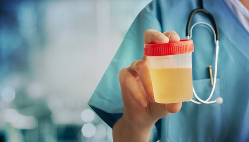 Imagen ilustrativa Orina espumosa