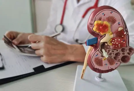 Imagen ilustrativa insuficiencia renal