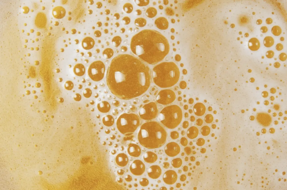 Imagen ilustrativa orina espumosa