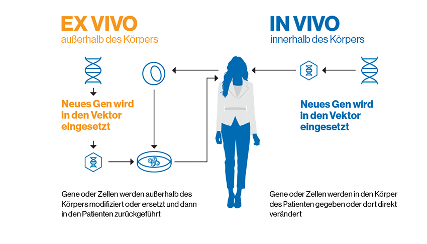 Einmal eingesetzt, gibt es zwei Möglichkeiten, um das neue Gen zu übertragen– ex vivo oder in vivo
