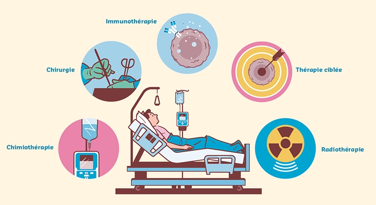 Infographic Melanome