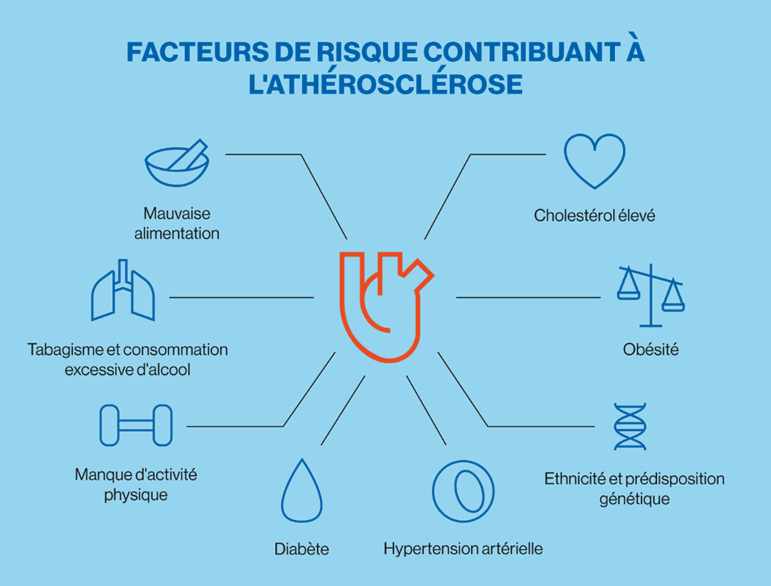 Infographic maladies cardiovasculaires