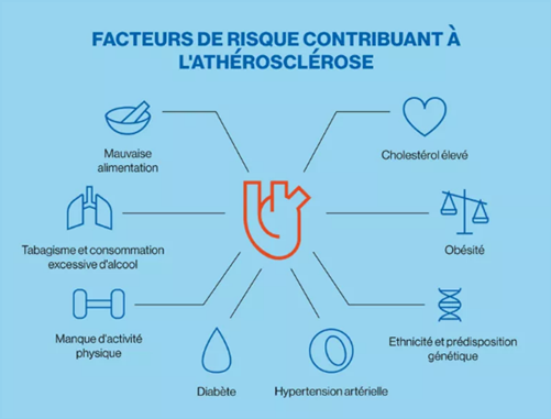 Infographic - les facteurs de risque cardiovasculaires 