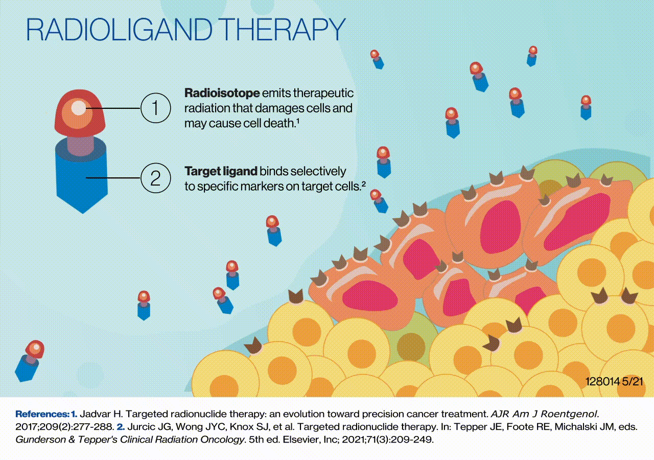 Infographic radioligandtherapy