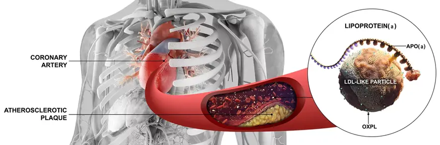 Infographic Lipoproteïne 