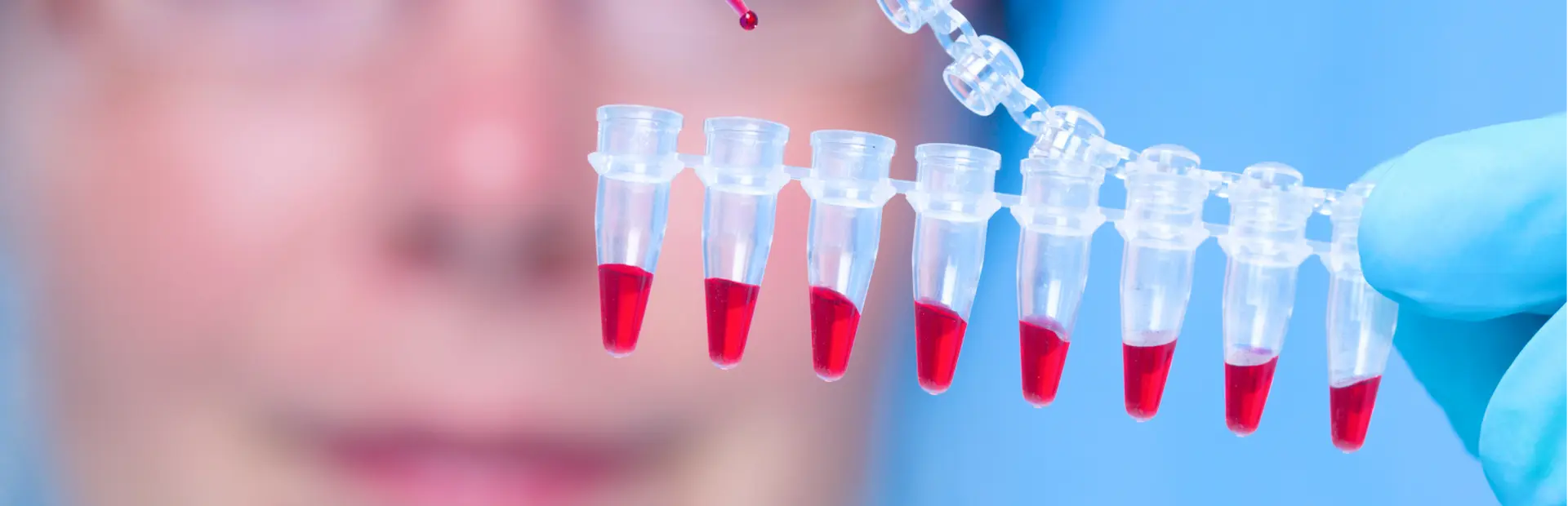 Полицитемия вера