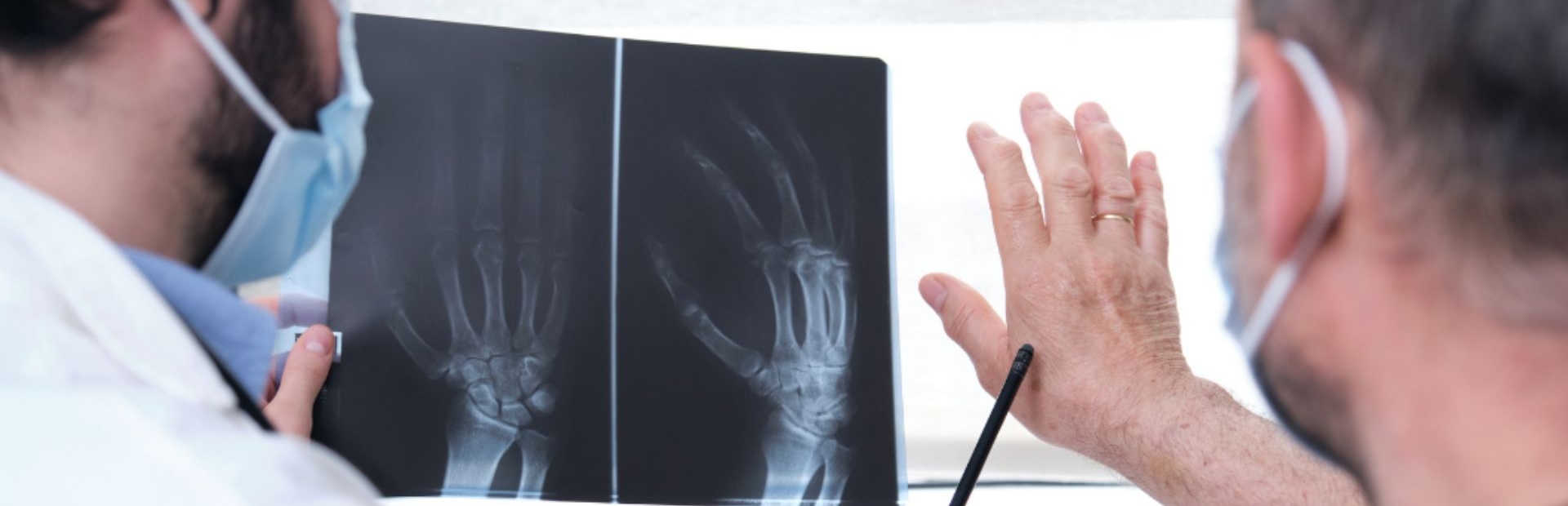 psoriatichen artrit - banner 