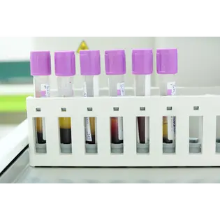 hematology cover image