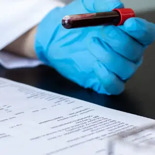 Полицитемия вера