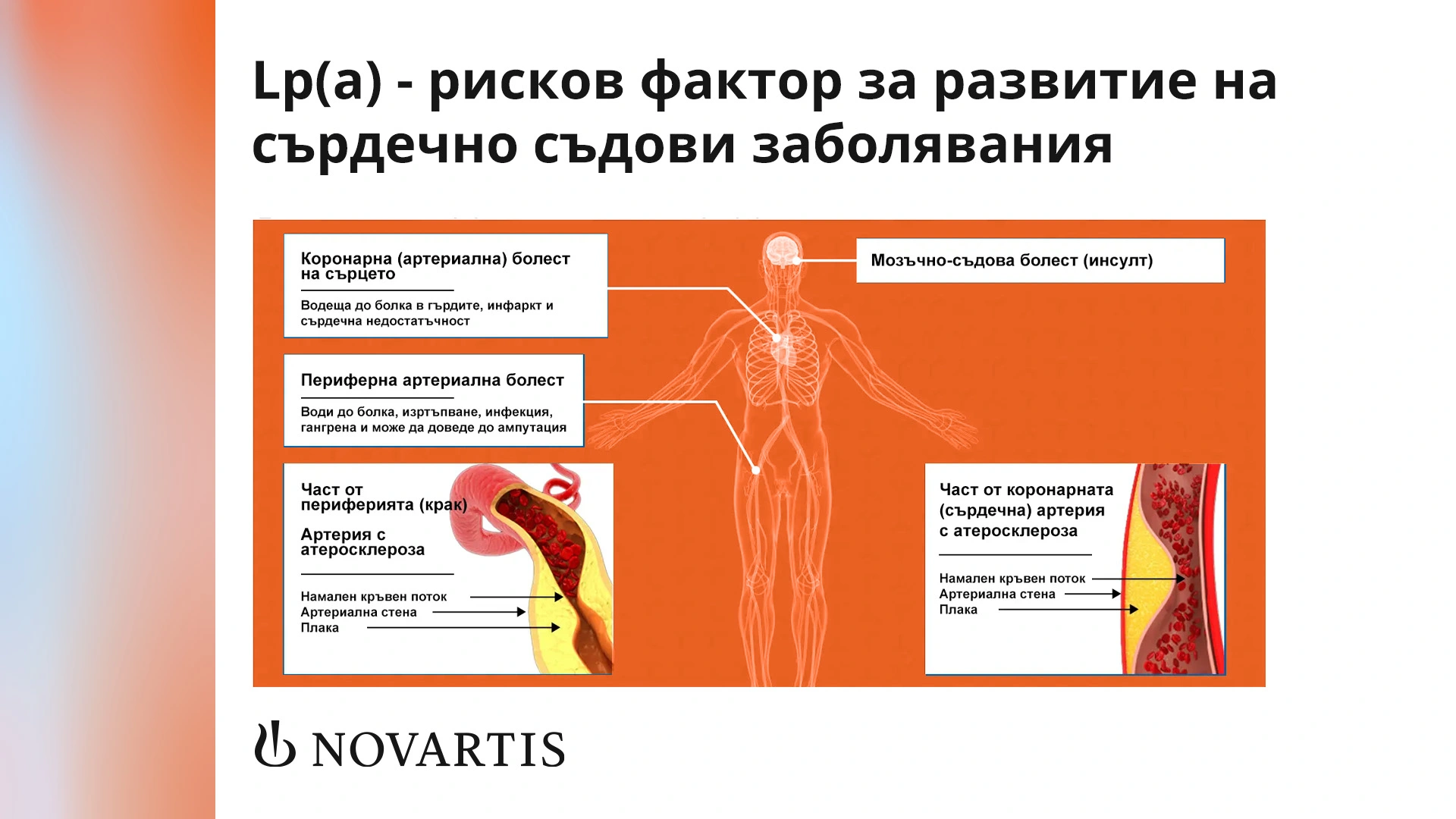 Какви са сърдечно съдовите рискове от повишения липопротеин (а)