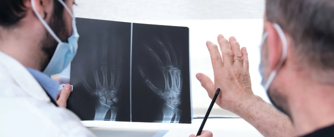 psoriatichen artrit - banner 