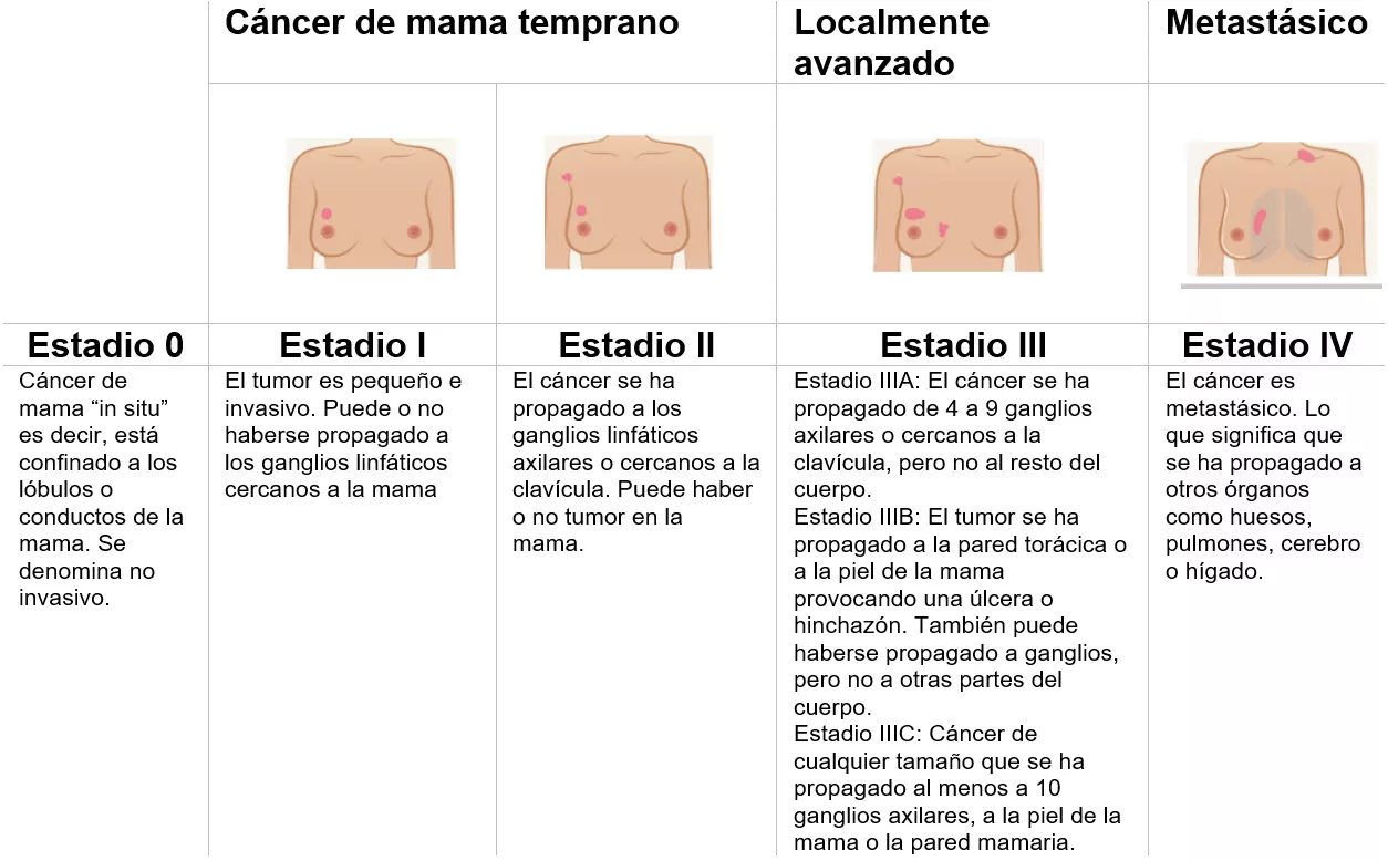Estadios del cáncer de mama
