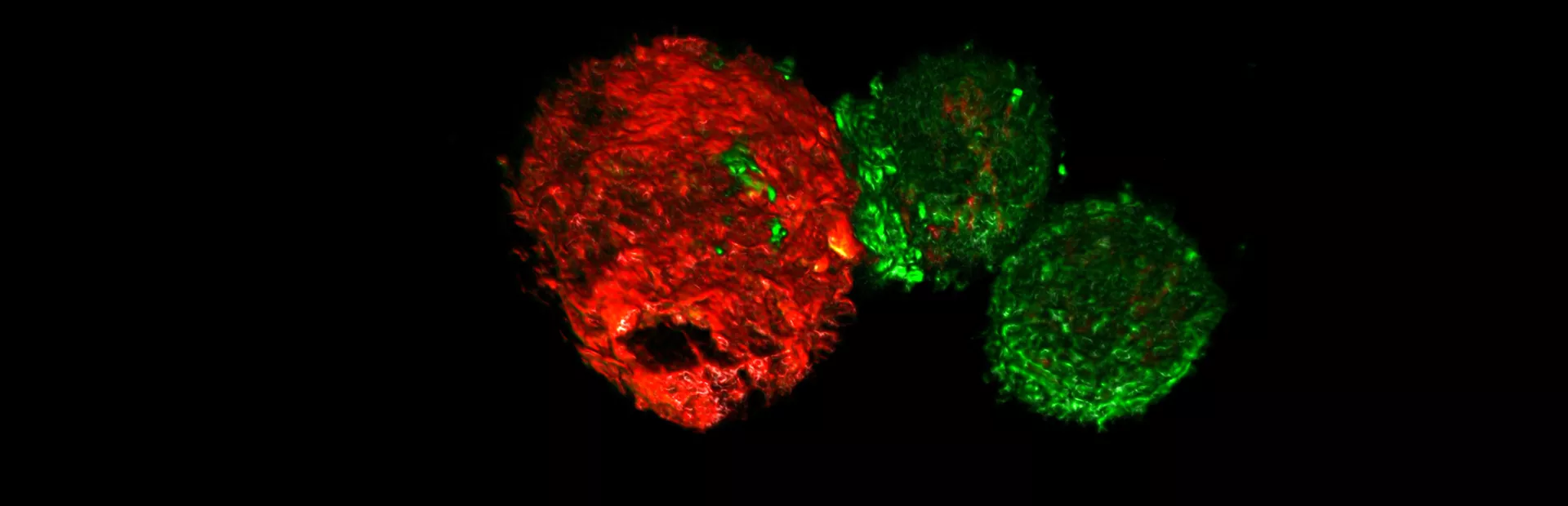 Eine CAR-T Zelle (grün) greift eine Tumorzelle (rot) an / Une cellule CAR-T (verte) attaque une cellule tumorale (rouge)