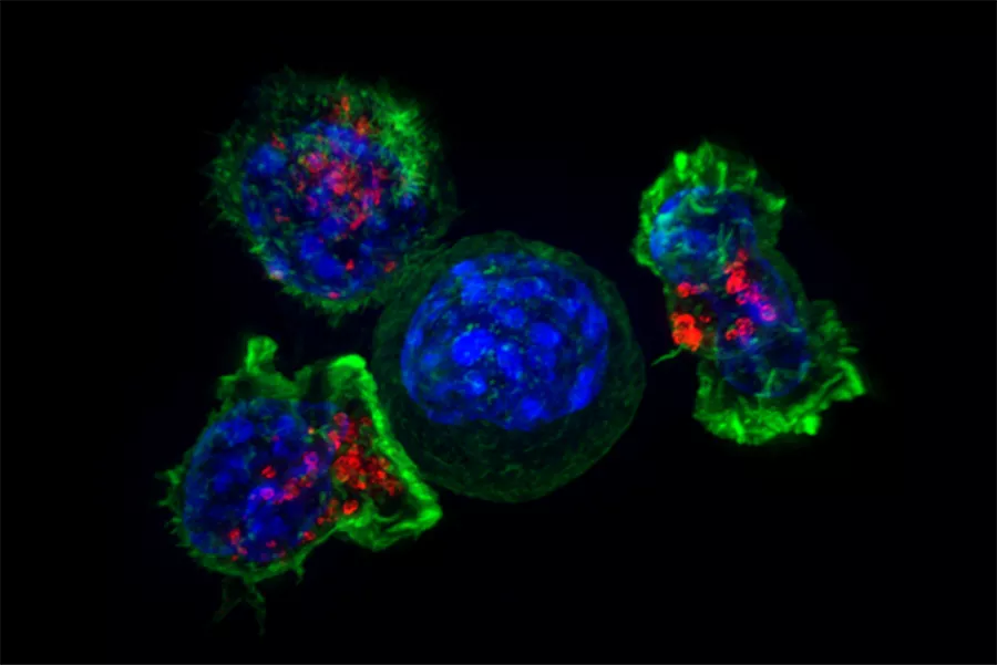 Weisse Blutkörperchen umgeben eine Krebszelle