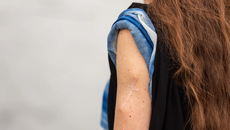 Des traces d’une intervention potentiellement mortelle: Natascha revendique ses cicatrices.)