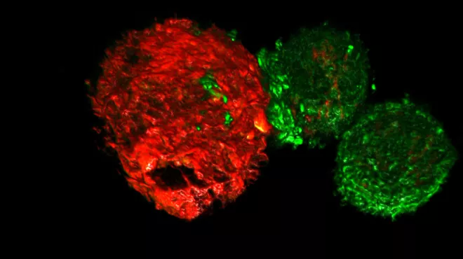 Eine CAR-T Zelle (grün) greift eine Tumorzelle (rot) an / Une cellule CAR-T (verte) attaque une cellule tumorale (rouge)