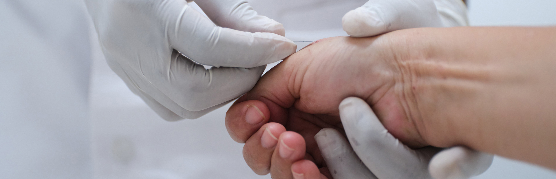 Arzt nimmt Blutproben von einem Patienten