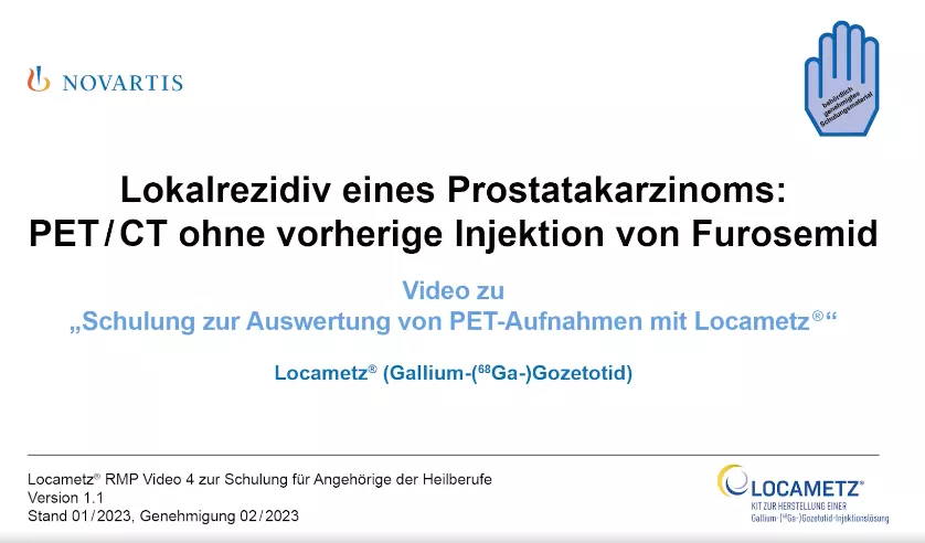 Video 4 Klinische Fallbeispiele - Lokalrezidiv eines Prostatakarzinoms: PET/CT ohne vorherige Injektion von Furosemid