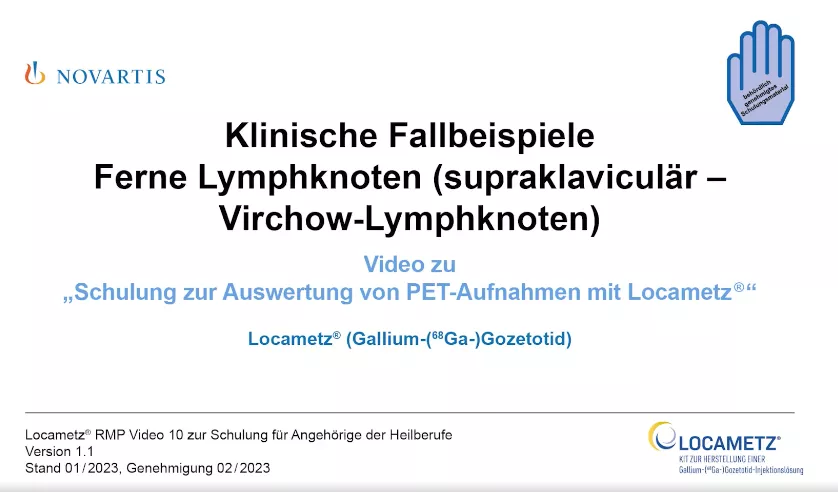 Video 10 Klinische Fallbeispiele - Ferne Lymphknoten (supraklaviculär – Virchow-Lymphknoten)
