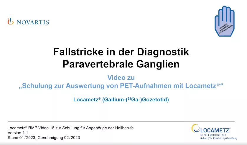 Video 16 Fallstricke in der Diagnostik - Paravertebrale Ganglien
