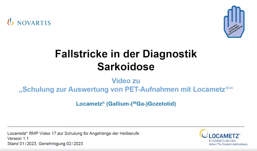 Video 17 Fallstricke in der Diagnostik - Sarkoidose