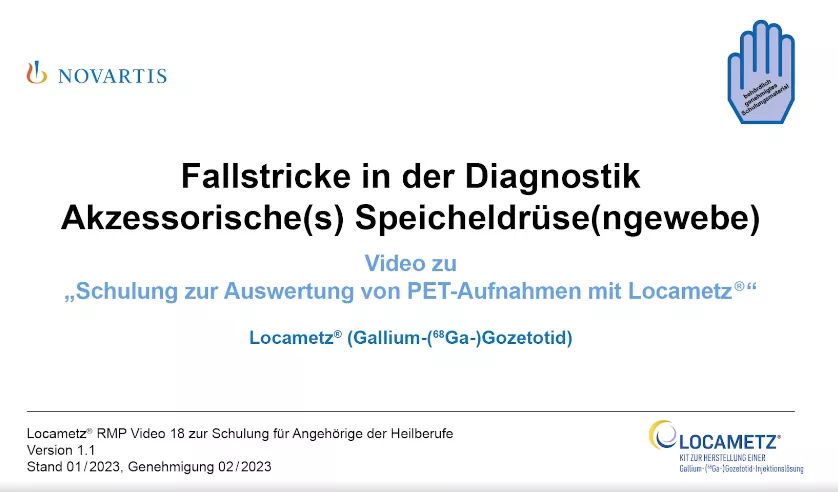 Video 18 Fallstricke in der Diagnostik - Akzessorische(s) Speicheldrüse(ngewebe)