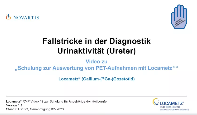 Video 19 Fallstricke in der Diagnostik - Urinaktivität (Ureter)