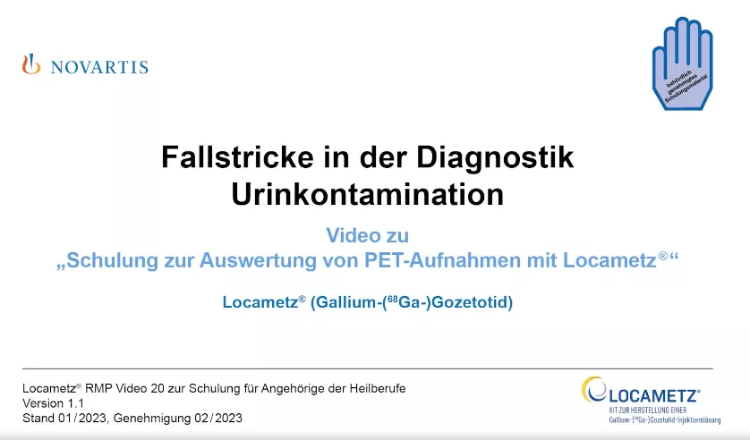Video 20 Fallstricke in der Diagnostik - Urinkontamination