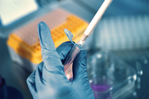Labortechniker bereitet eine Probe mit einer Pipette vor.