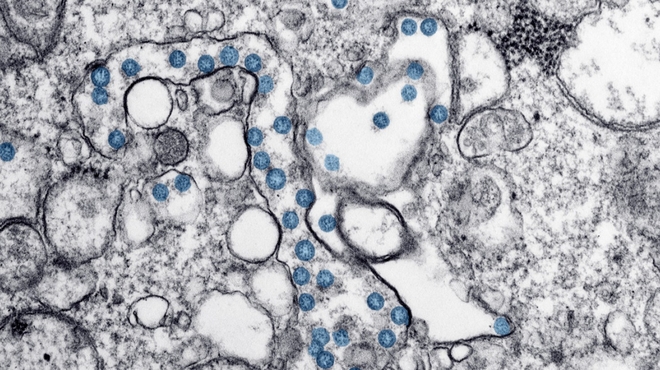 Transmission electron microscopic image of an isolate from a case of COVID-19 Transmission electron microscopic image of an isolate from a case of COVID-19