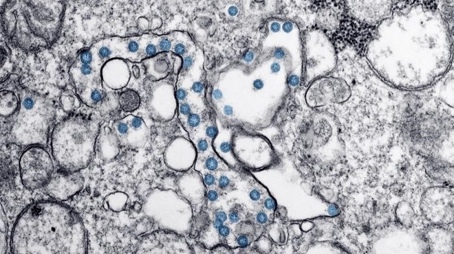 Illustration: Coronavirus (Centers for Disease Control and Prevention) 