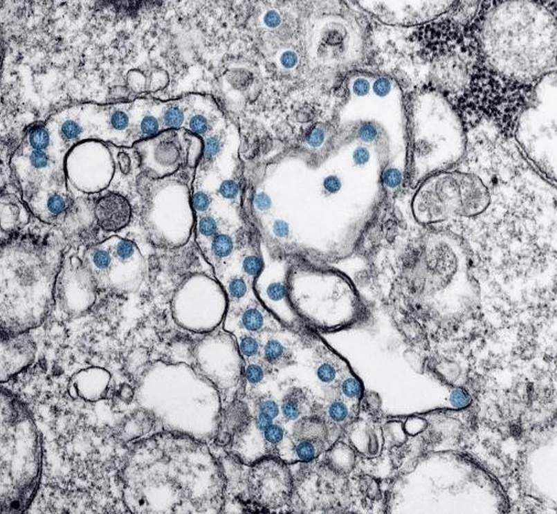 Coronavirus (Centers for Disease Control and Prevention)