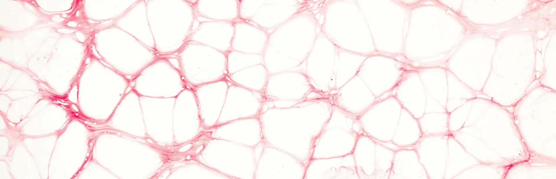 Imagen de la estructura de un tumor