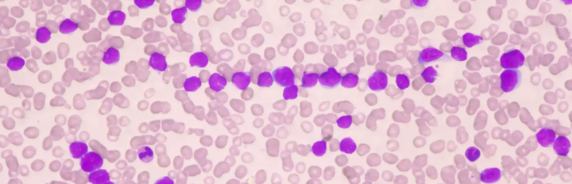 Imagen microscópica de leucocitos