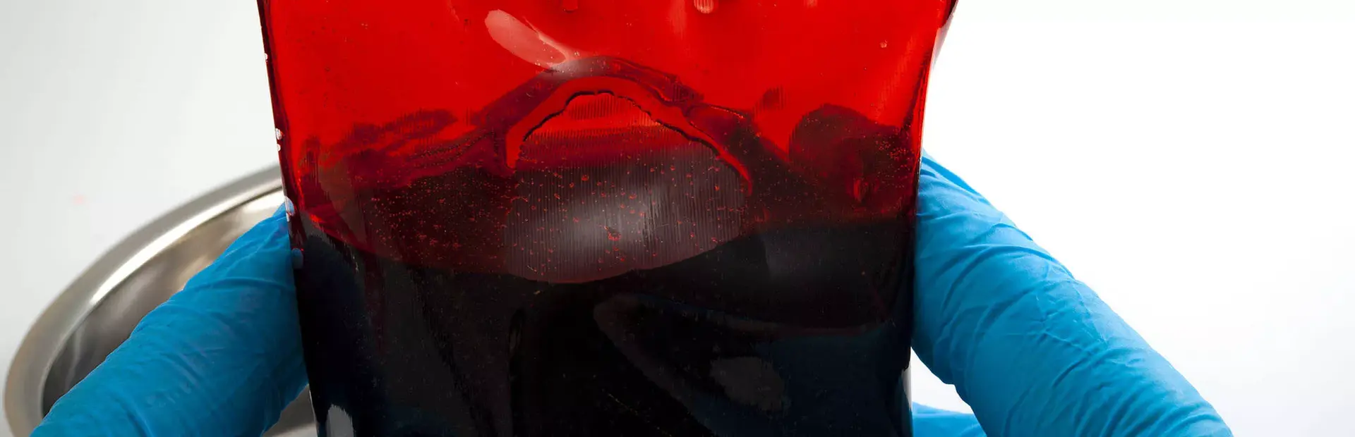 Transfusión de sangre