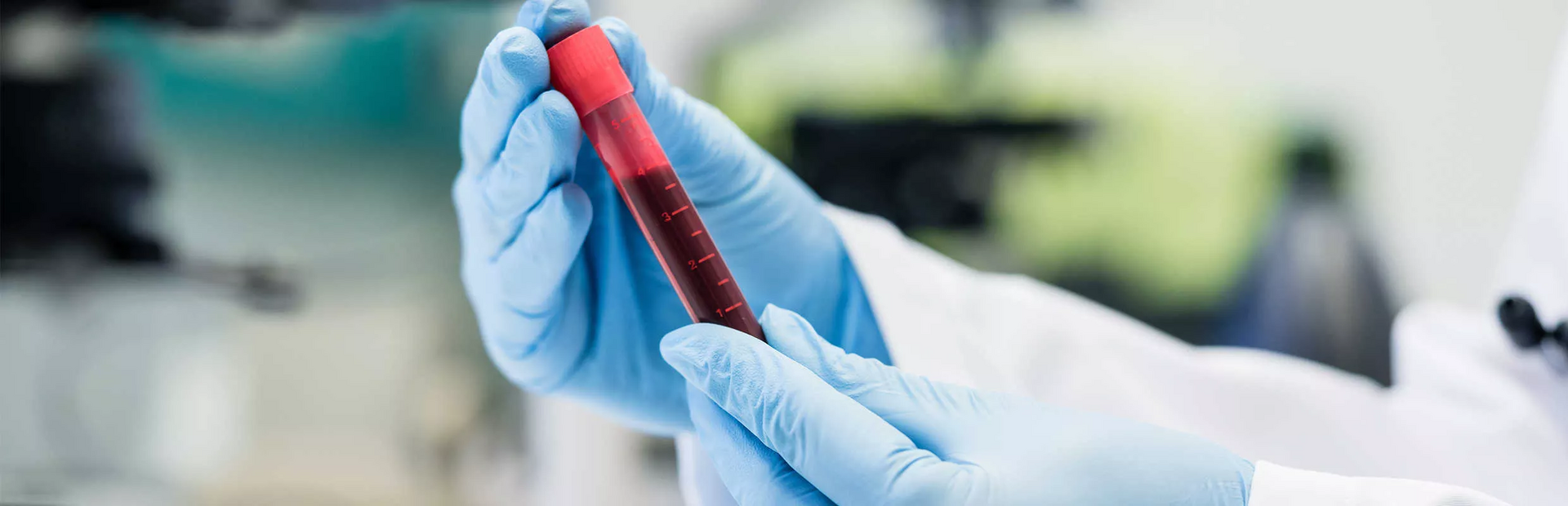 Tubo de ensayo con muestra de sangre