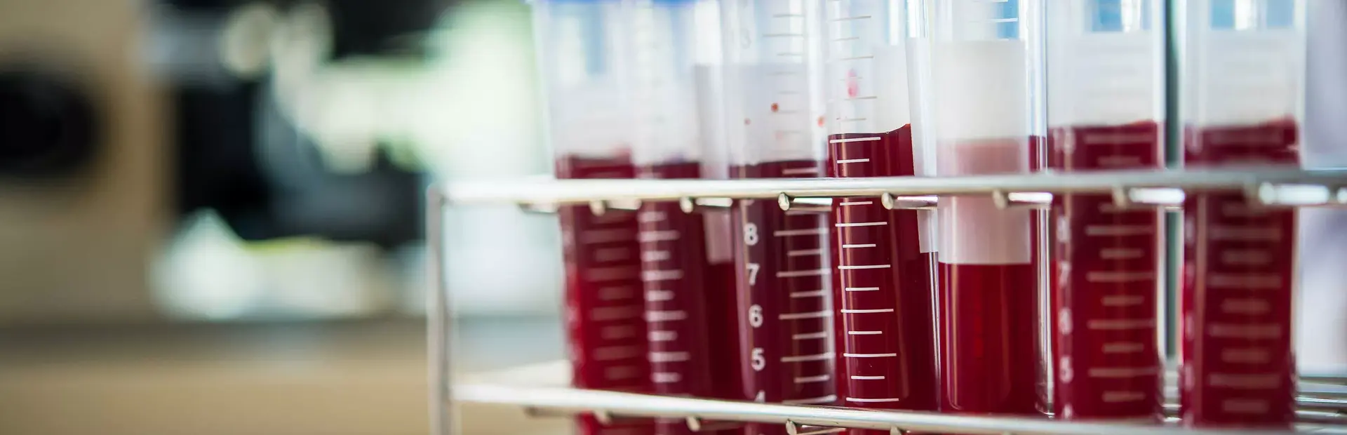 Tubos de ensayo con muestras de sangre