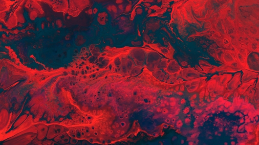 Imagen digital de un tumor neuroendocrino en infrarrojos