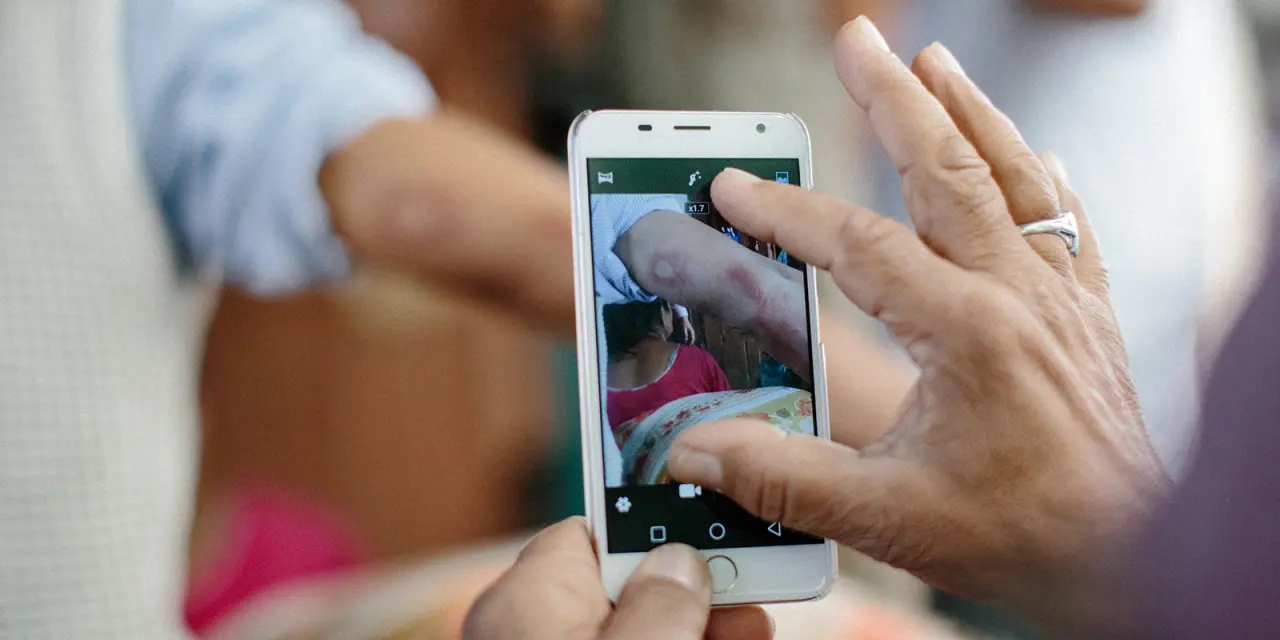 Detección precoz de la lepra