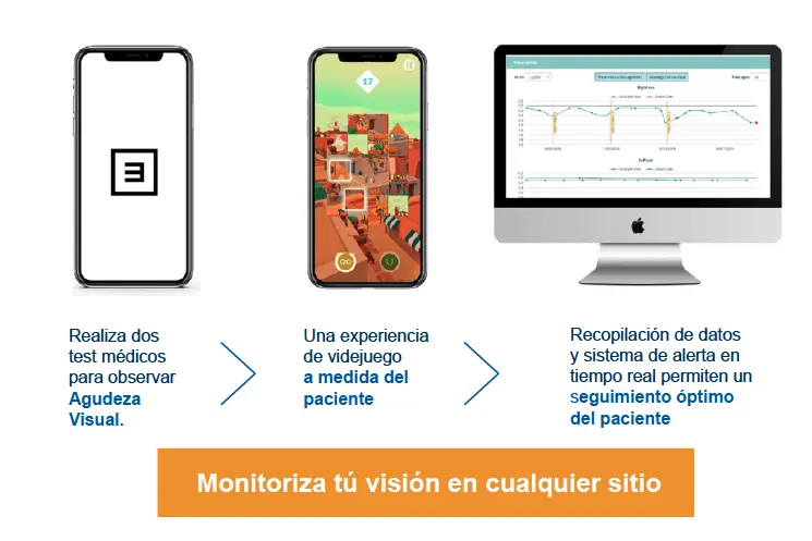 Proyecto Odisight del área de Oftalmología