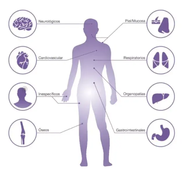 Síntomas de la mastocitosis