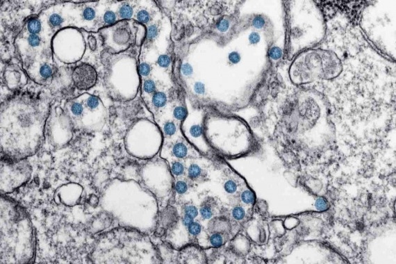 Coronavirus