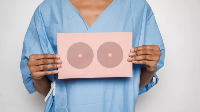 Paciente con cáncer de mama 