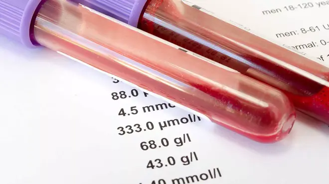 Tubos de ensayo con muestras de sangre 