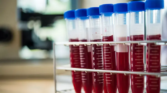 Tubos de ensayo con muestras de sangre