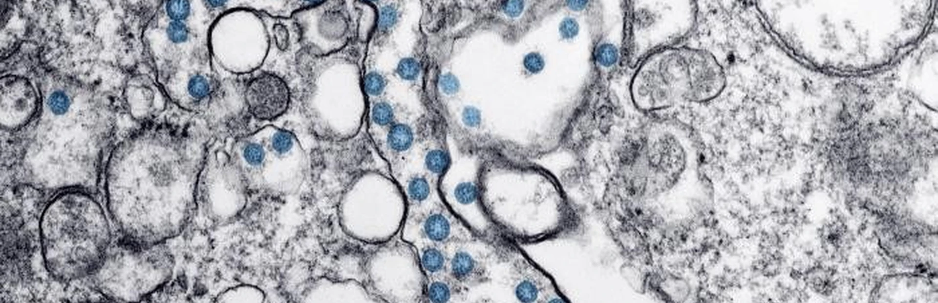 Coronavirus microscopic image