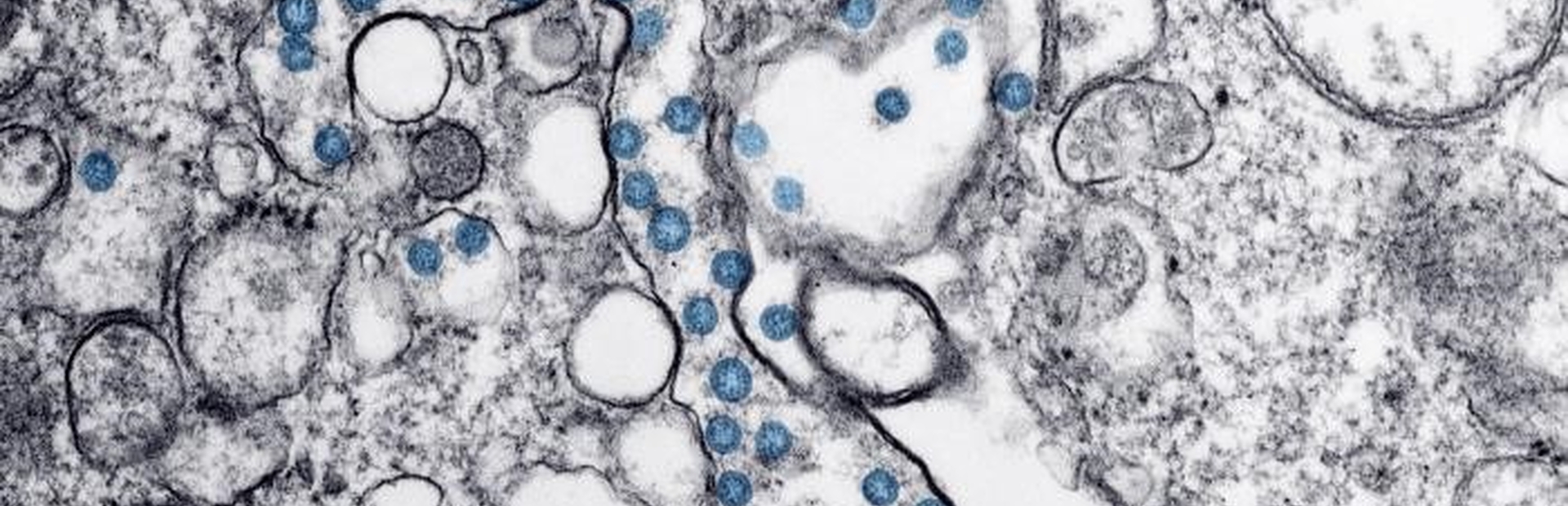 Coronavirus microscopic image