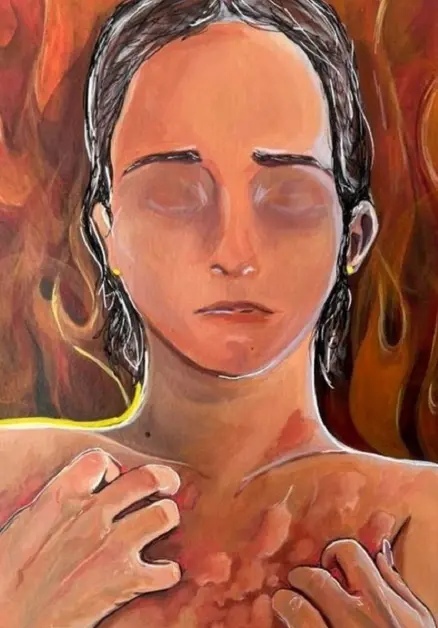 Artist depiction of CSU