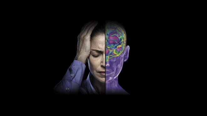 Image of woman holding her head with pain