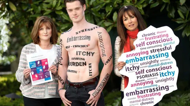 Burden of Psoraisis group image